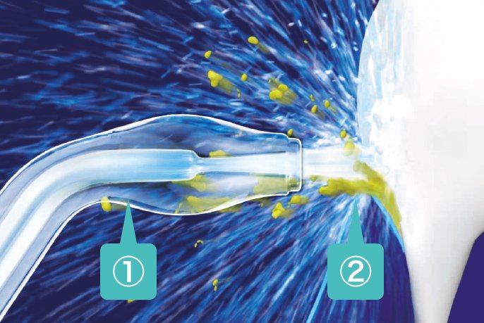 ジェットウォッシャードルツ EW-DJ75